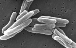 La tuberculose bovine